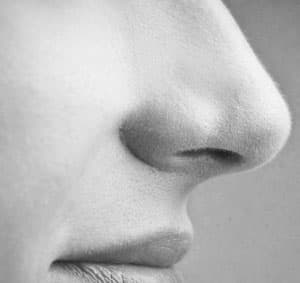 Pre-operative nasal profile assessment