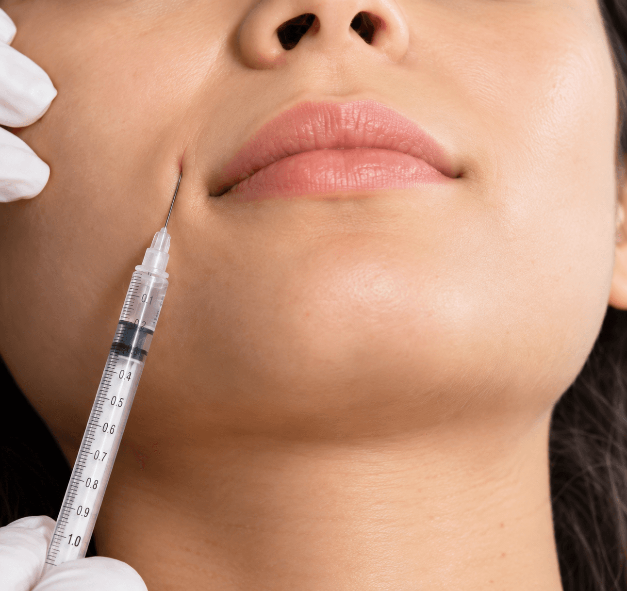 Dermal Fillers