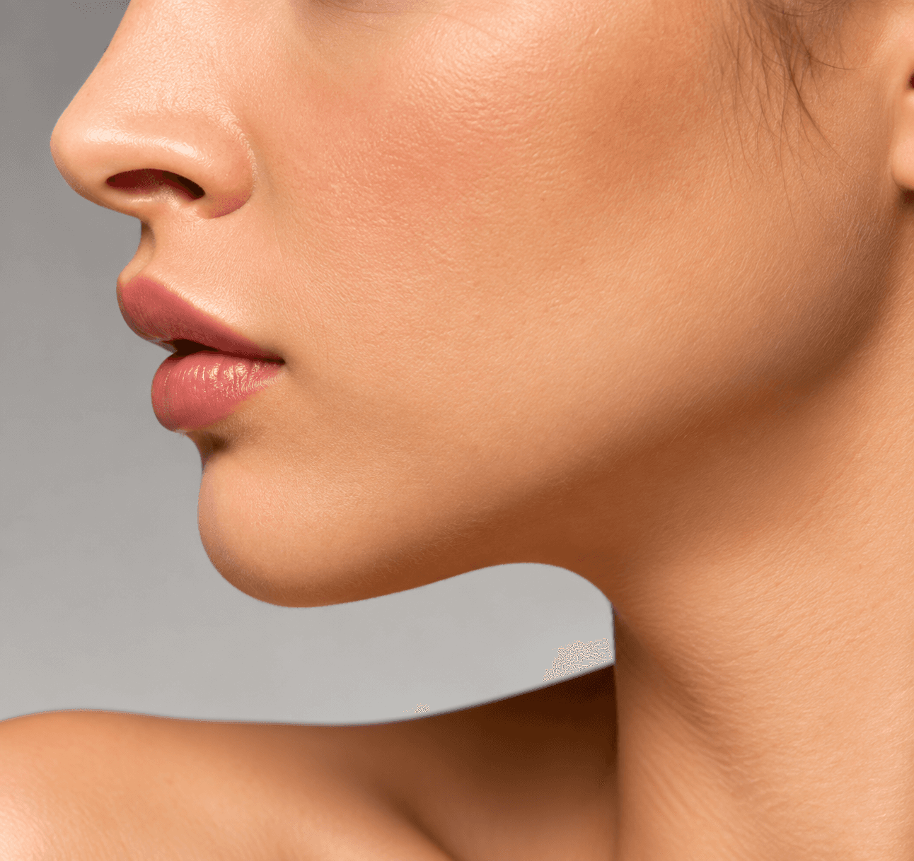 Otoplasty