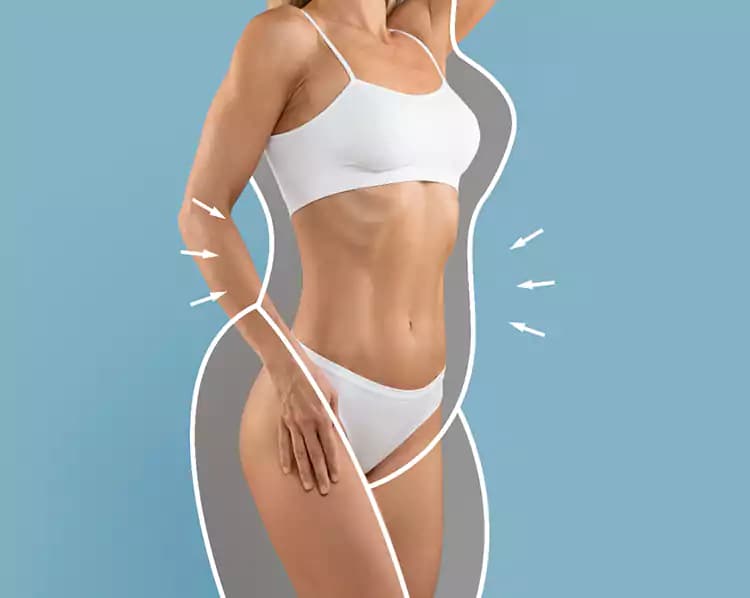 Illustration of a contoured waist and thighs after BodyTite