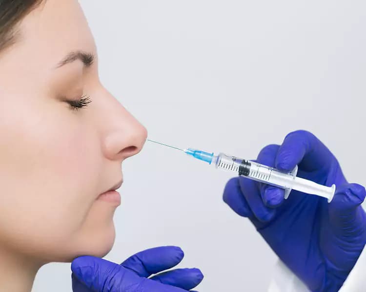 Nose filler for non-surgical rhinoplasty