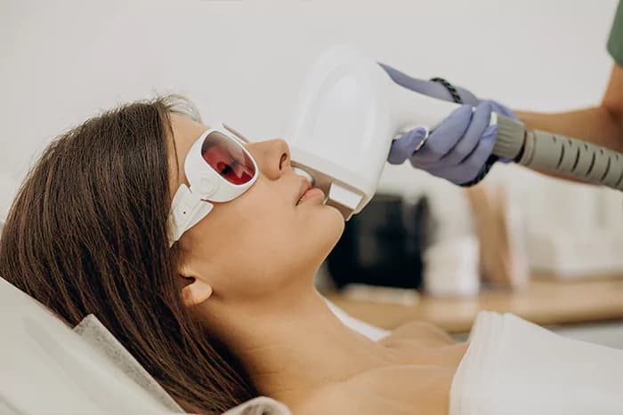 Facial laser hair removal