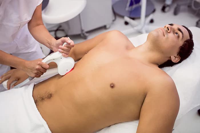 Laser hair removal on a man's chest