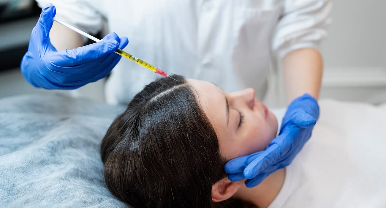 Sample image illustrating PRP therapy, after view