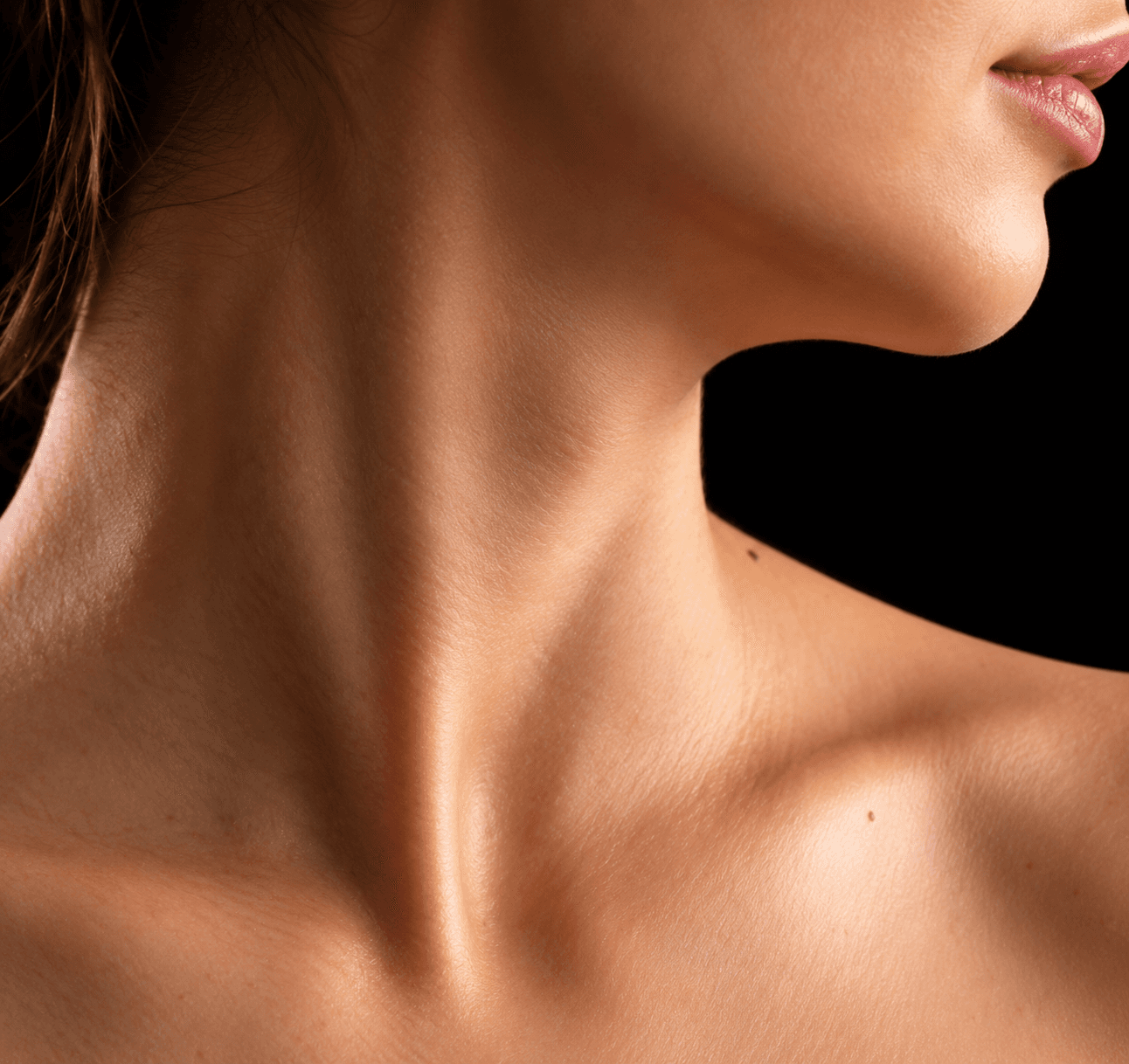 Sample image of the jawline and neck, after view