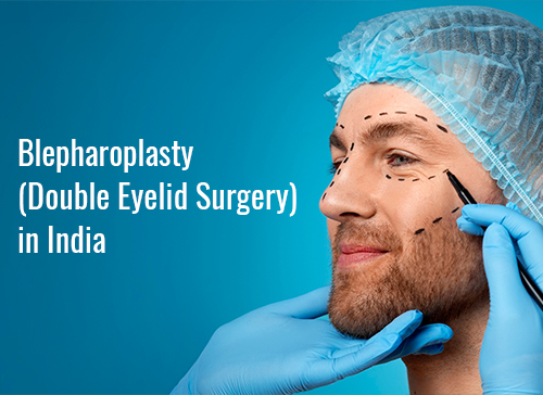 Blepharoplasty (Double Eyelid Surgery) in India