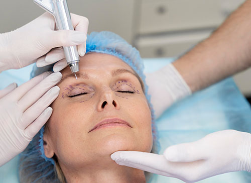 Boost your confidence with blepharoplasty in Delhi and NCR
