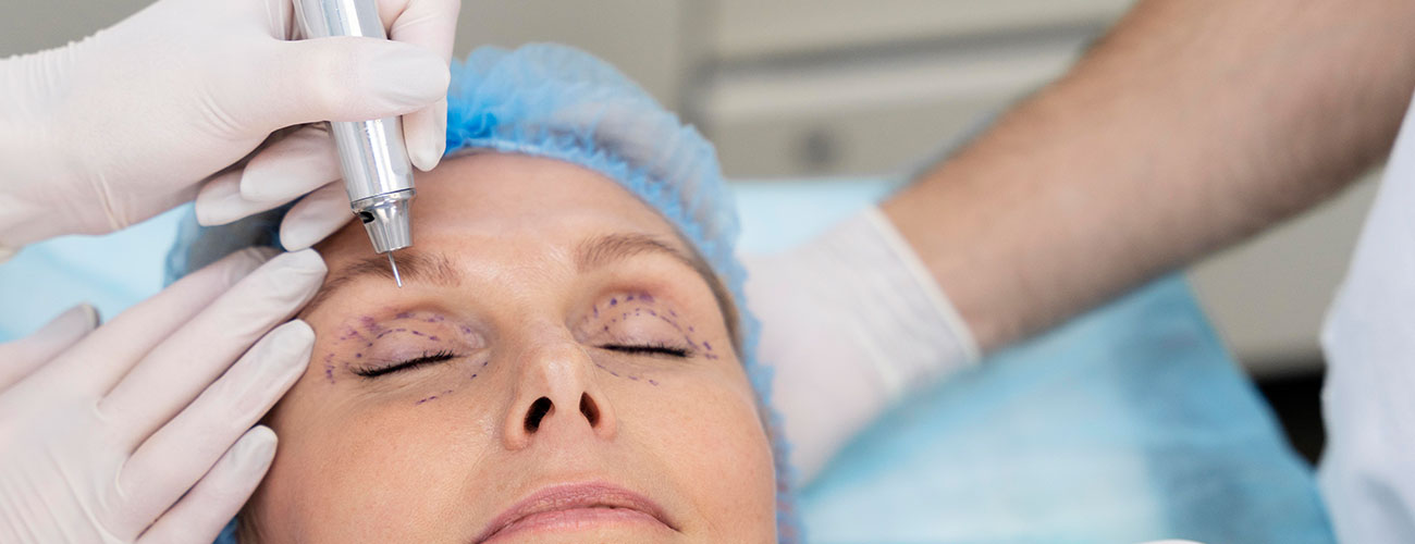 Boost your confidence with blepharoplasty in Delhi and NCR