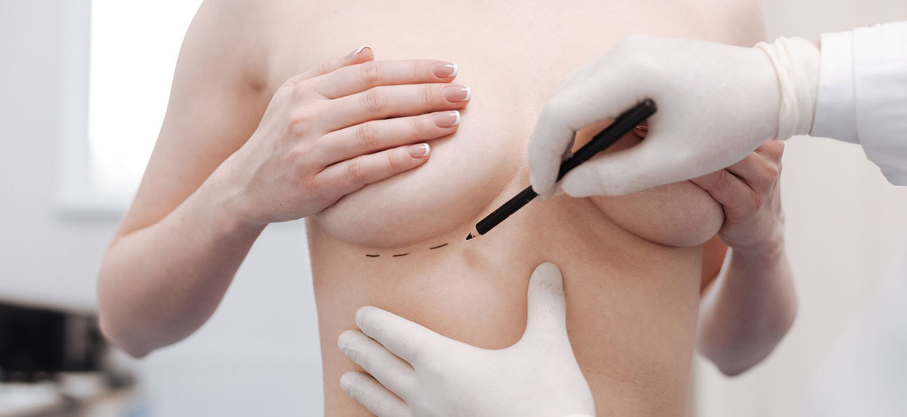 Factors Influencing Breast Implant Cost