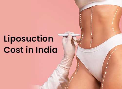 Liposuction Cost in India