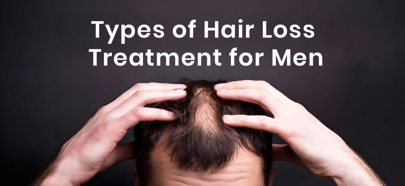 Types of Hair Loss Treatment for Men