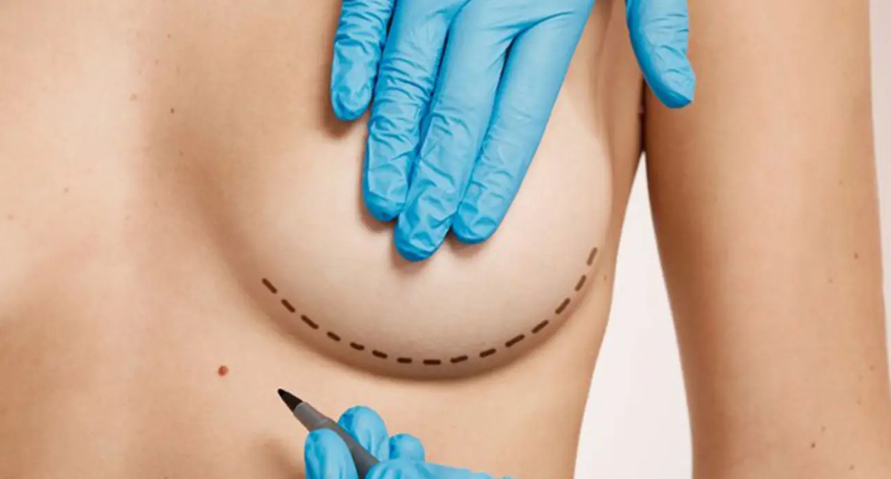 Breast Augmentation Surgery in Delhi