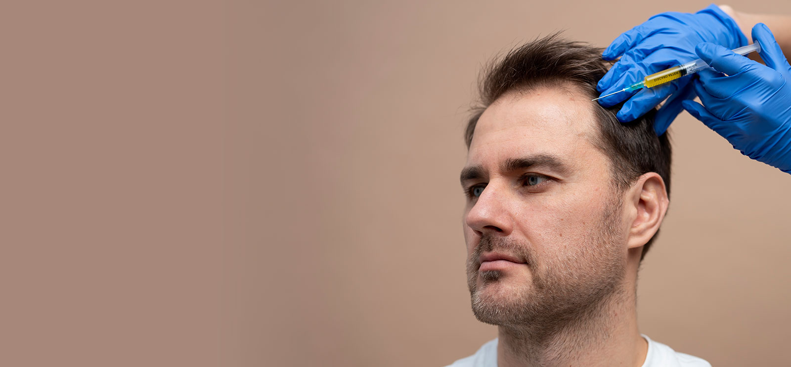 hair transplant in greater kailash