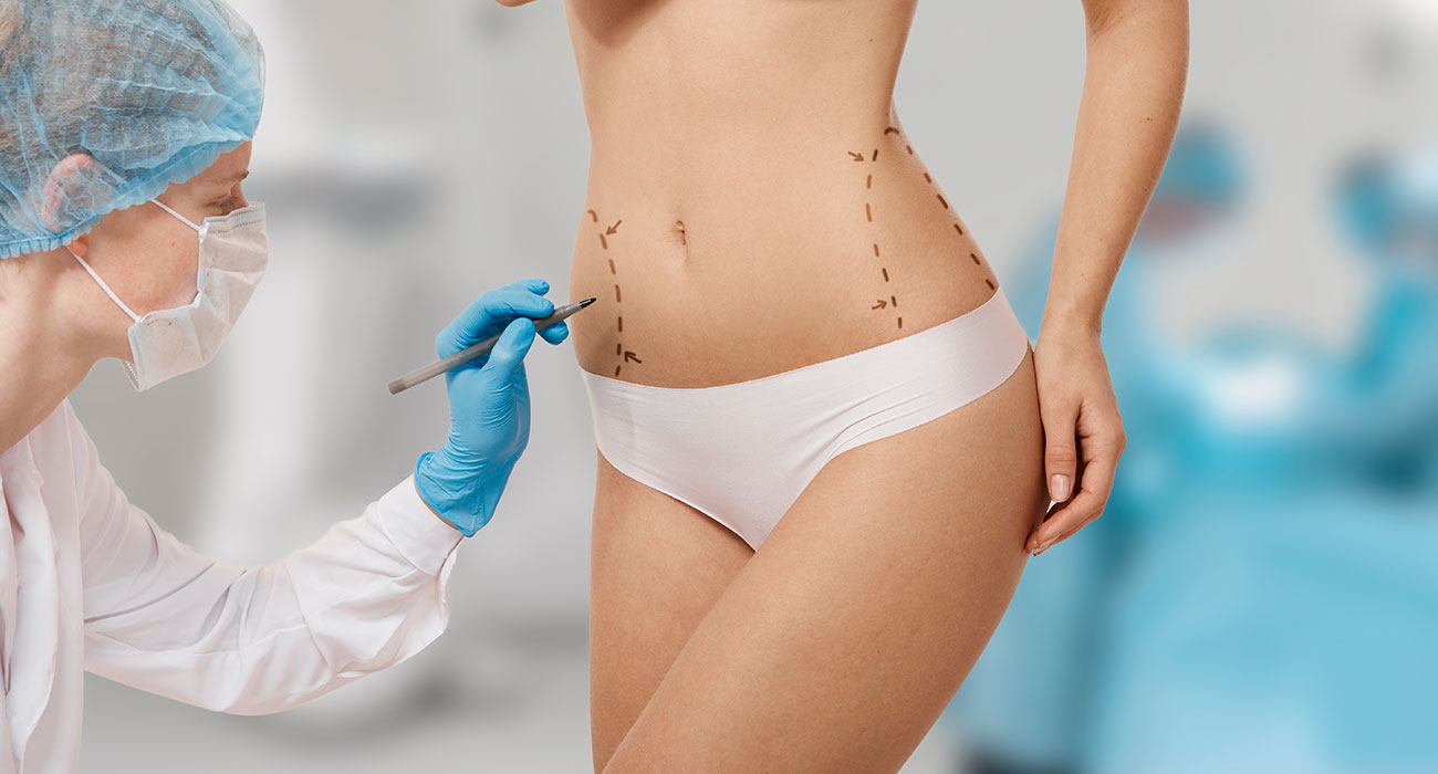 Liposuction Surgery in Delhi